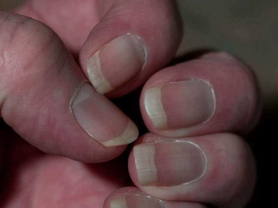 Hair and fingernails continue to grow after death. 